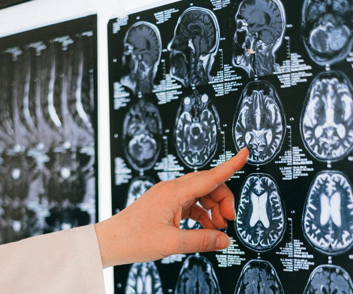 Traumatic<br>Brain Injury